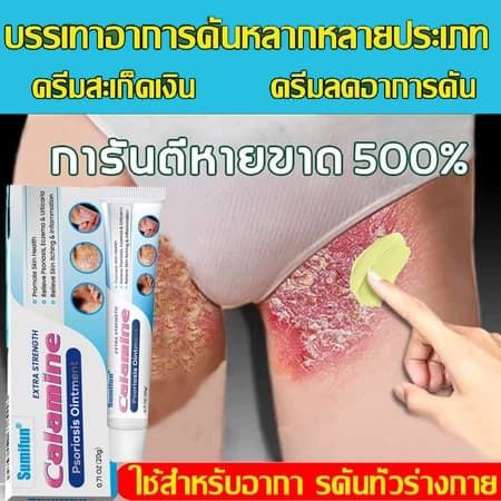 💫ครีมทาสังคัง สะเก็ดเงินครีม ครีมบำรุงผิว 20g รอยแดง โรคผิวหนัง เกลื้อน กลาก คัน สมุนไพร แก้คันเรื้อรัง คันในร่มผ้า