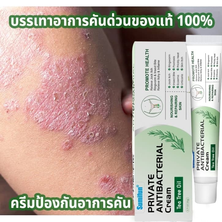 ☘️ครีมทาสังคัง สะเก็ดเงินครีม ครีมบำรุงผิว 20g รอยแดง โรคผิวหนัง เกลื้อน กลาก คัน สมุนไพร แก้คันเรื้อรัง คันในร่มผ้า